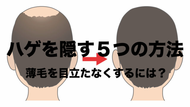 ハゲを隠すための５つの方法 男の悩み 薄毛を目立たなくするには フリーランスな笑い声